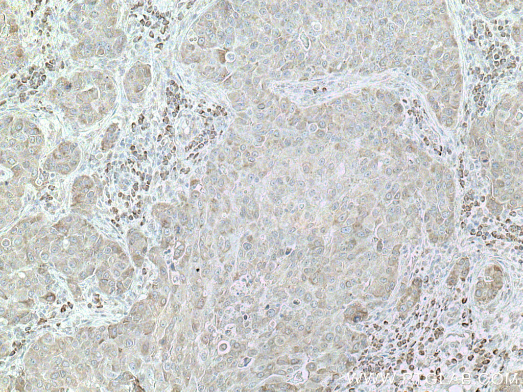 DNAJC1 Polyclonal antibody