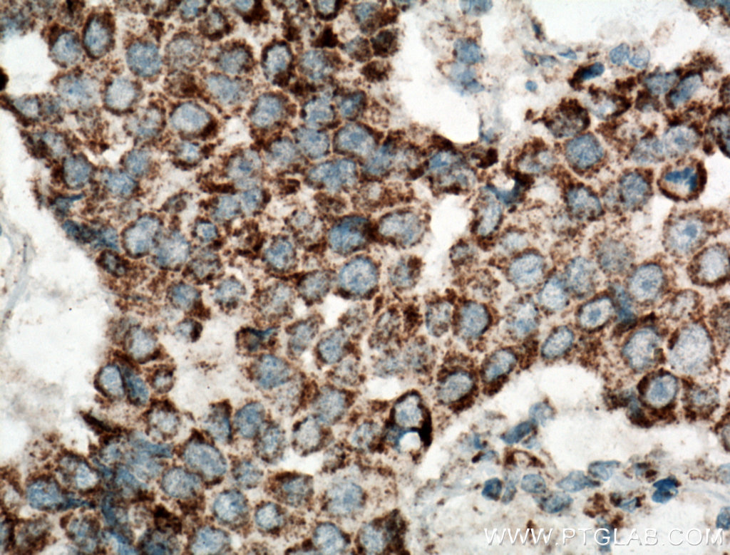 UQCRH Polyclonal antibody