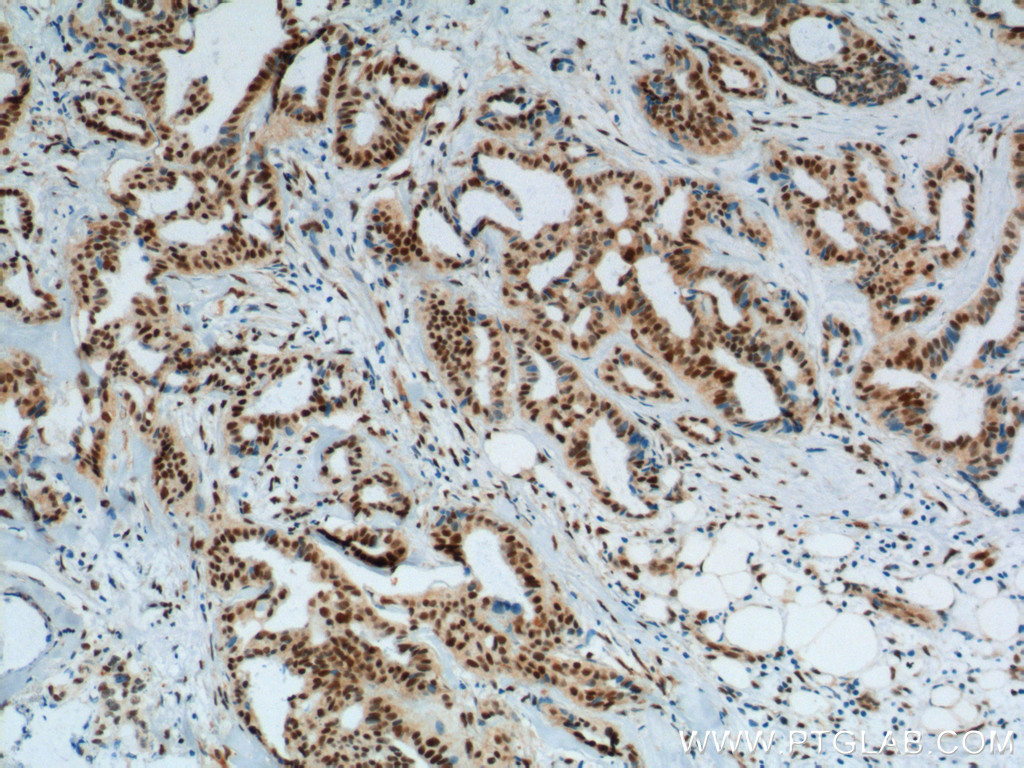 KPNA6 Polyclonal antibody