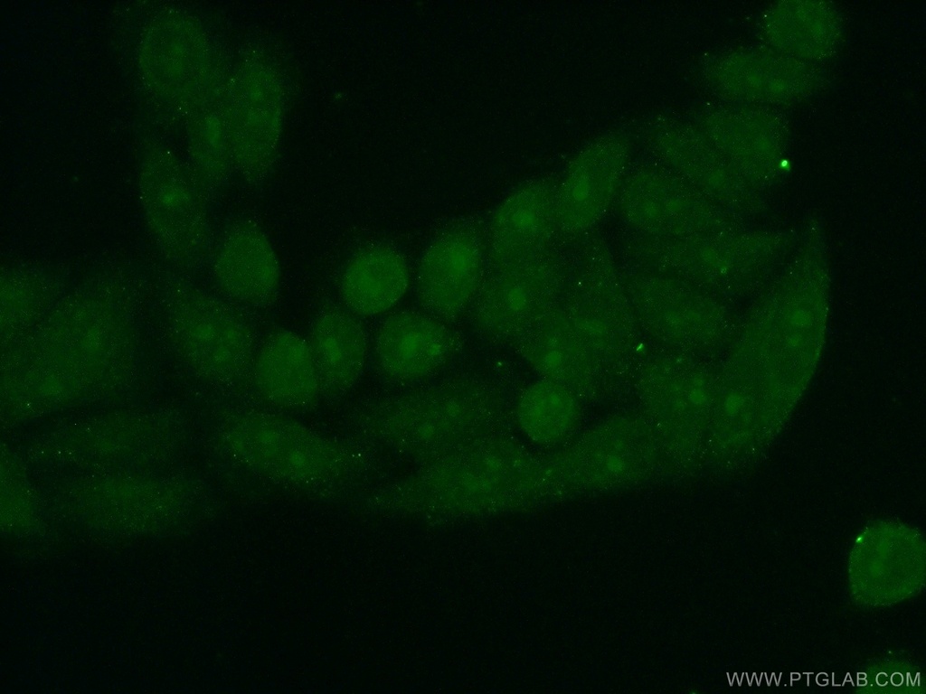 PINX1 Polyclonal antibody