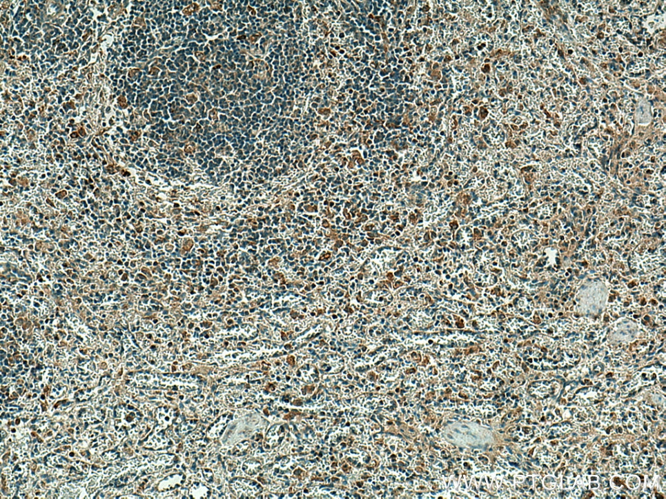 EBI3 Polyclonal antibody