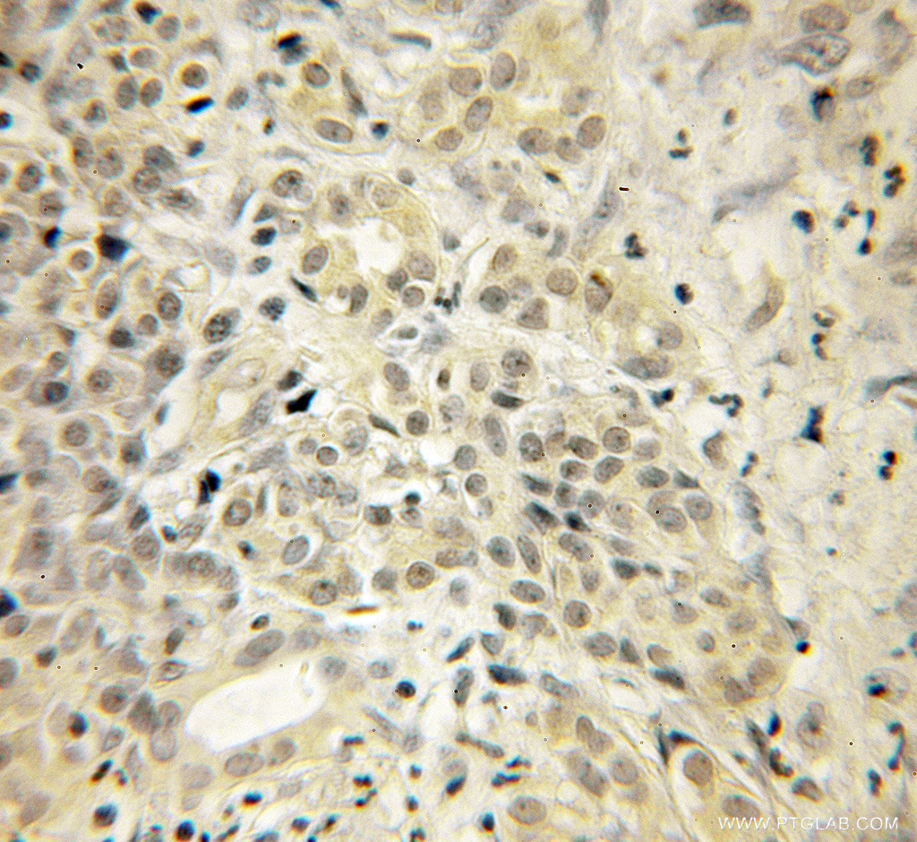 UCHL3 Polyclonal antibody