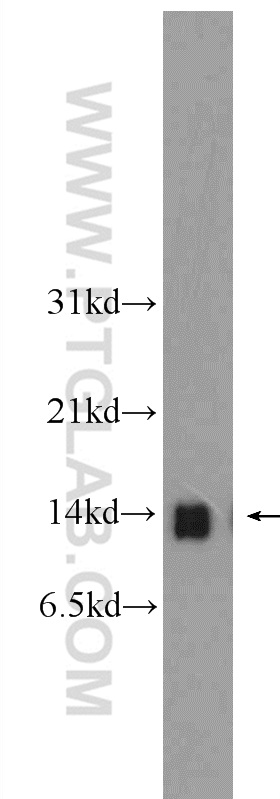 DDT Polyclonal antibody