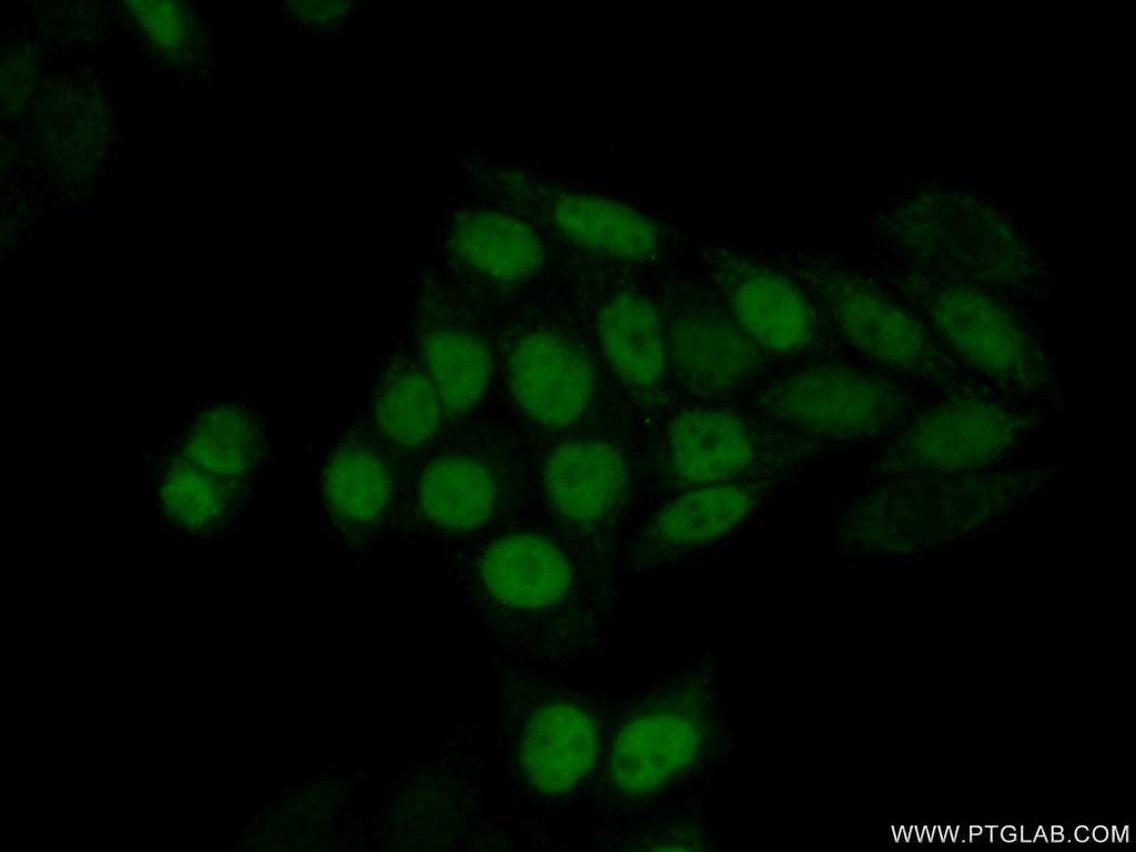 UNG Polyclonal antibody