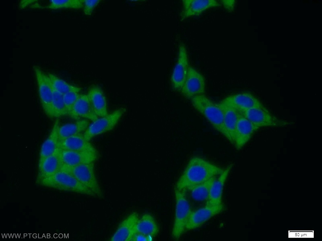 MAGEB1 Polyclonal antibody