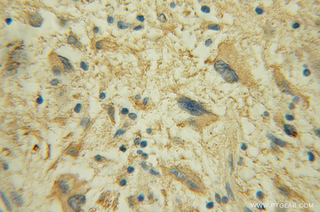 DPM1 Polyclonal antibody