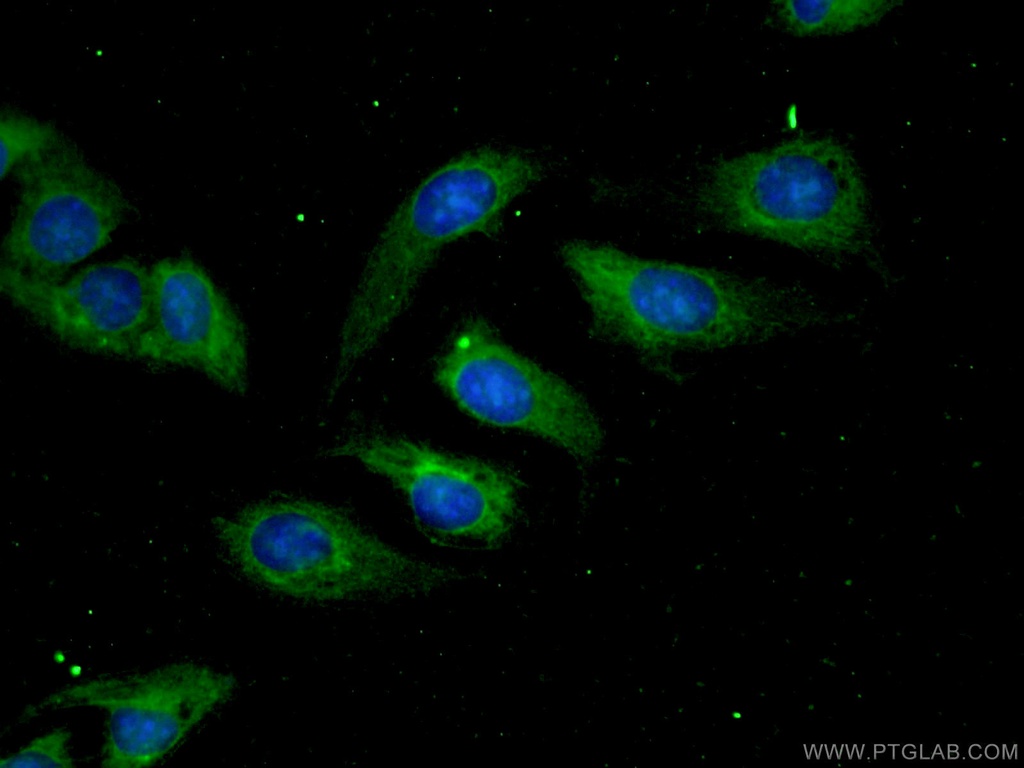 Aconitase 1 Polyclonal antibody
