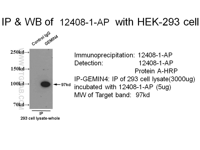GEMIN4 Polyclonal antibody