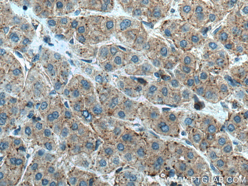 Alix Polyclonal antibody