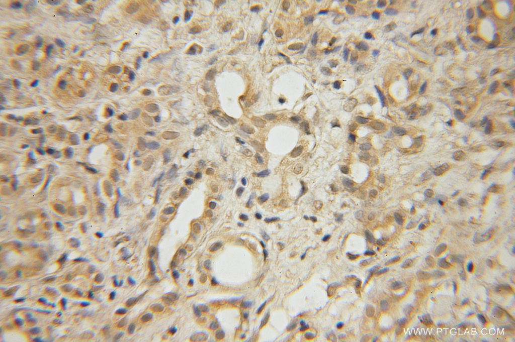 GLYCTK Polyclonal antibody