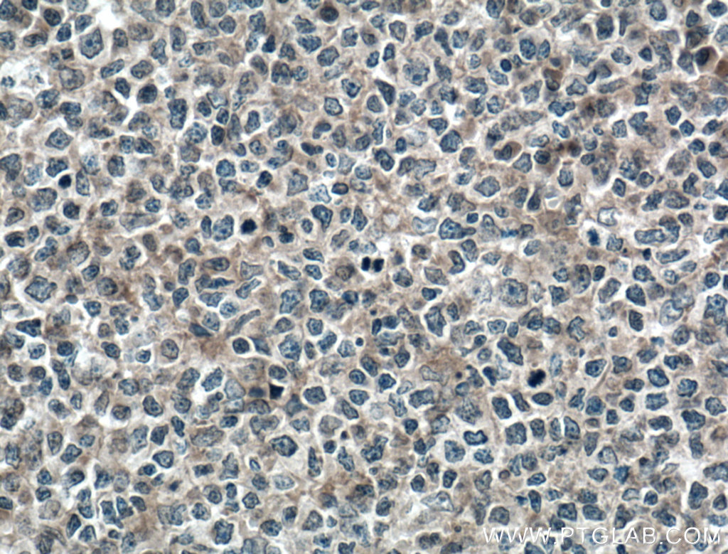 MYO9B Polyclonal antibody