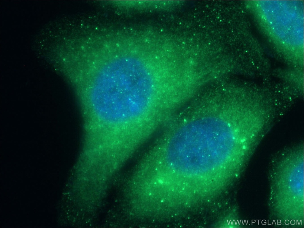 STAM Polyclonal antibody