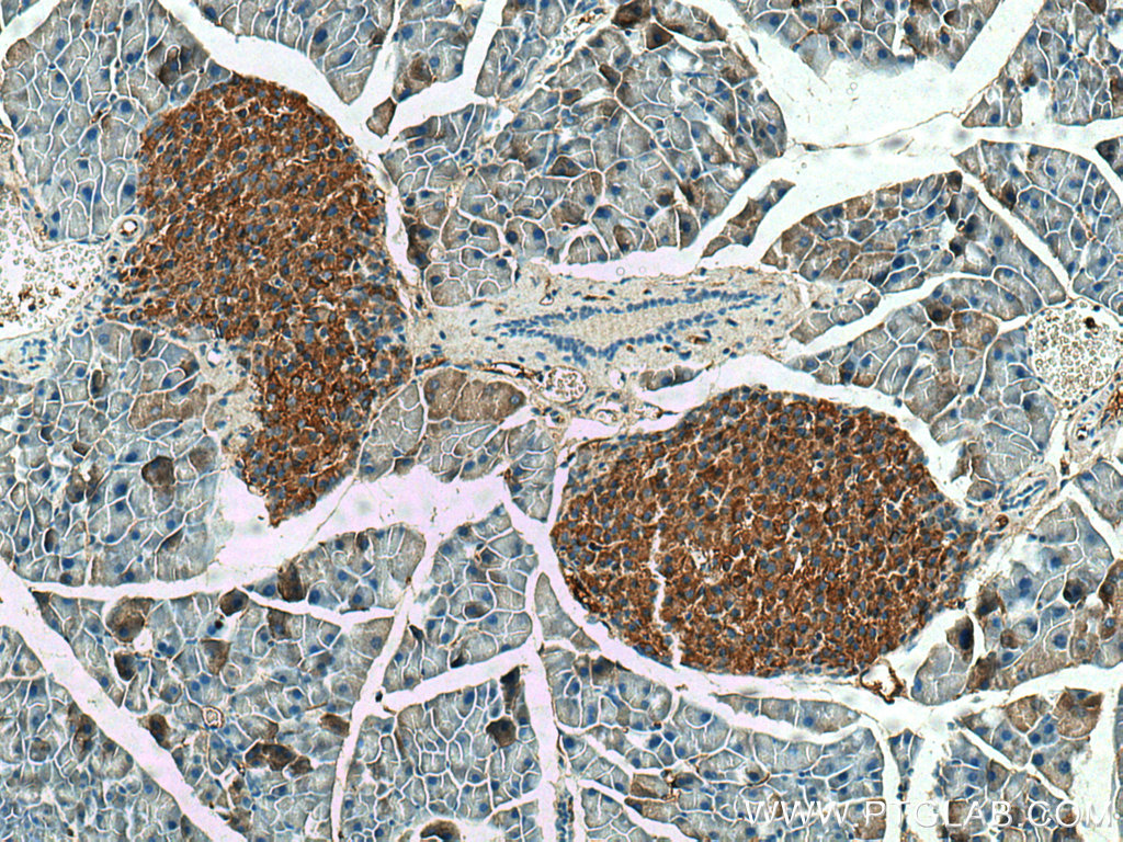 SHC3 Polyclonal antibody