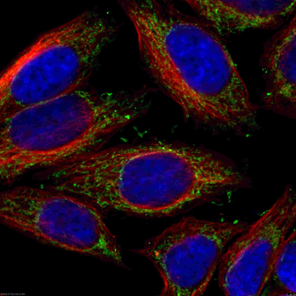 NDUFS1 Polyclonal antibody