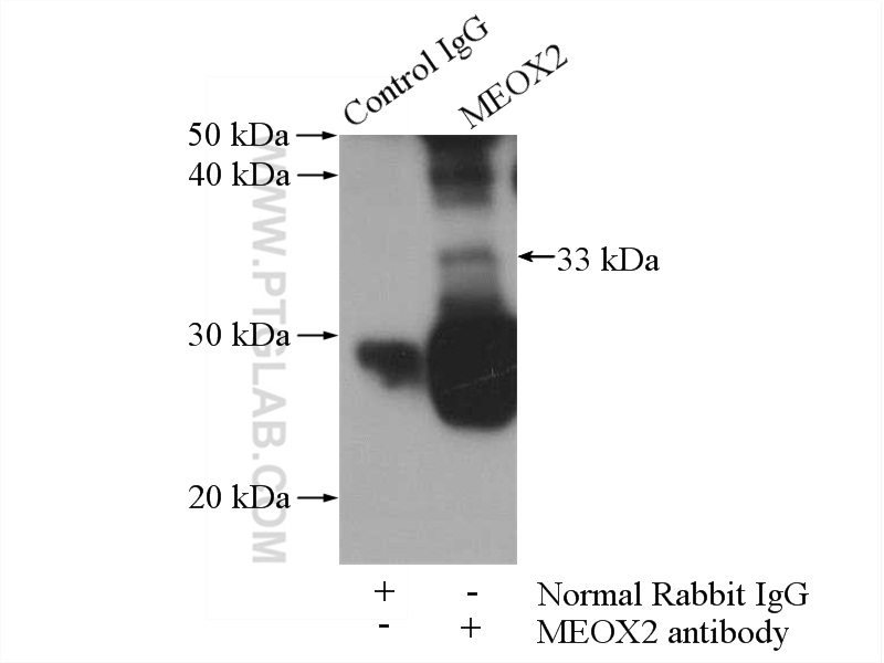 MEOX2 Polyclonal antibody