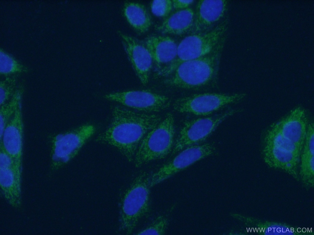 DBT Polyclonal antibody
