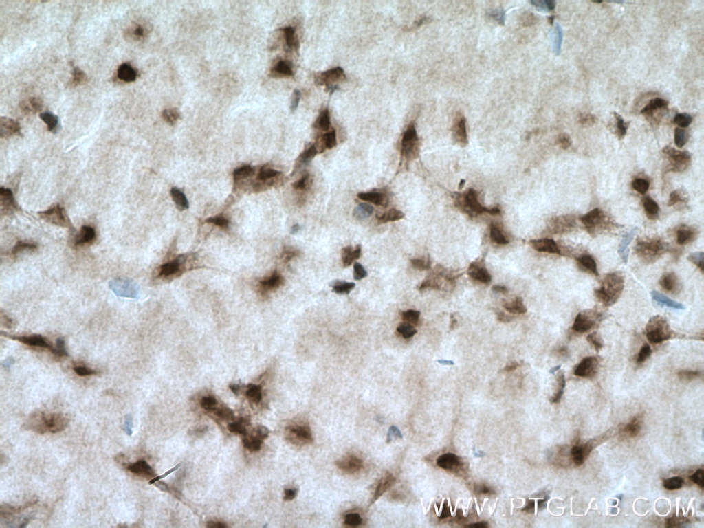 PAK4/6/7 Polyclonal antibody