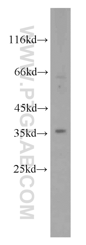 RHBDL2 Polyclonal antibody