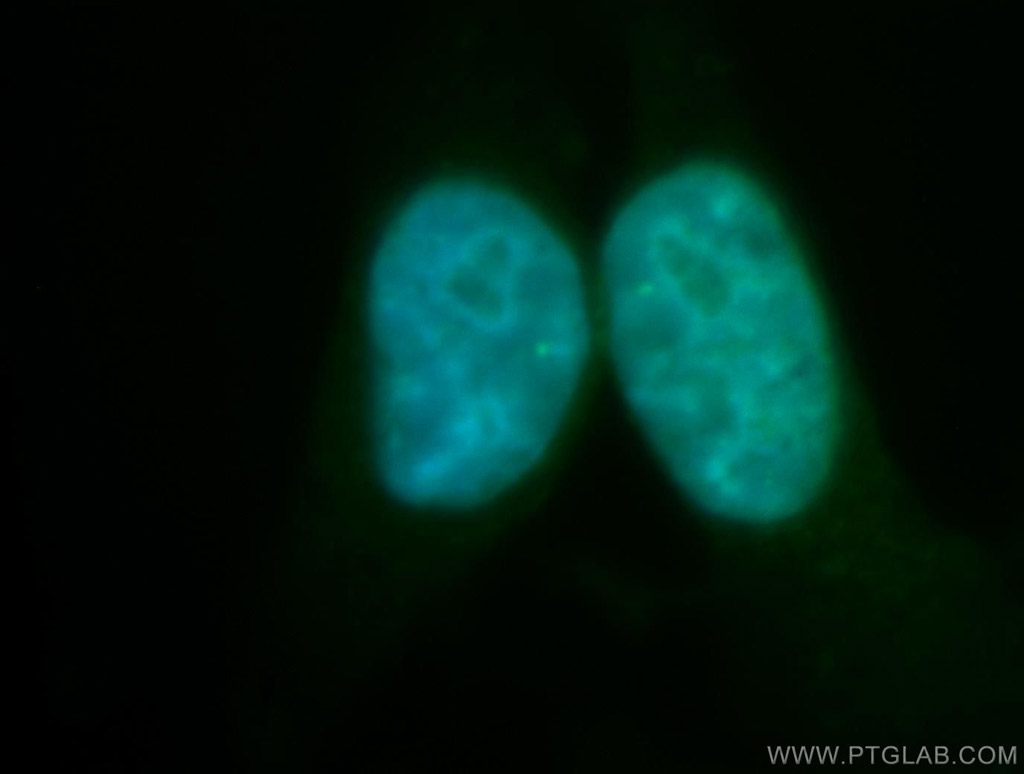 RECQL5 Polyclonal antibody