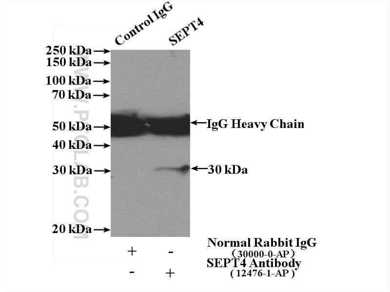 SEPT4 Polyclonal antibody