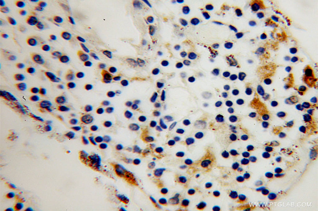 TPP1 Polyclonal antibody