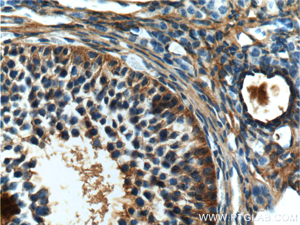 COQ6 Polyclonal antibody