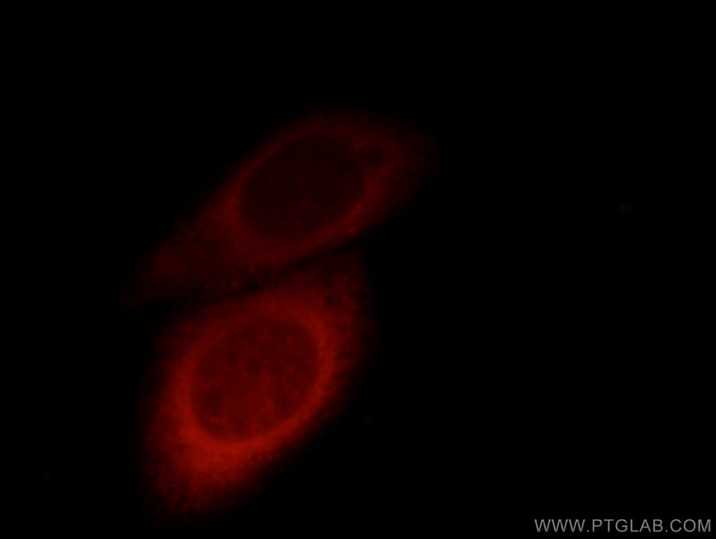 TBL2 Polyclonal antibody