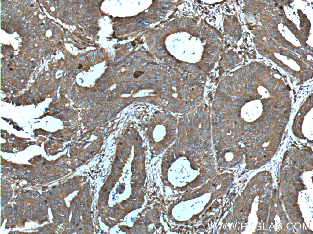 CD46 Polyclonal antibody