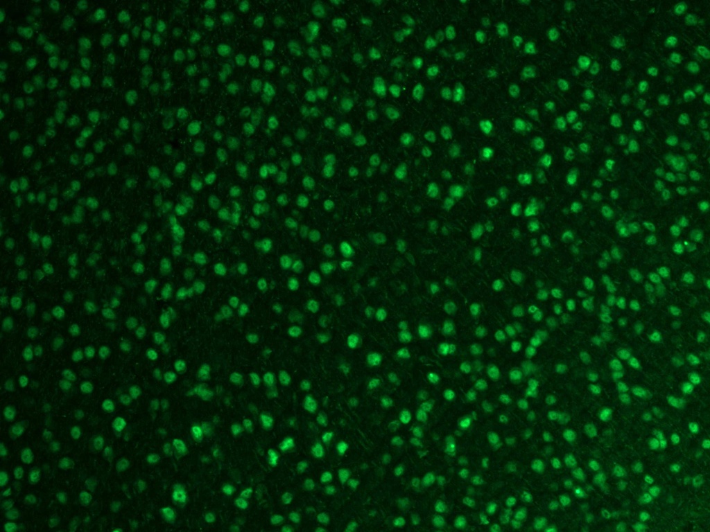 FOX2/RBM9 Polyclonal antibody