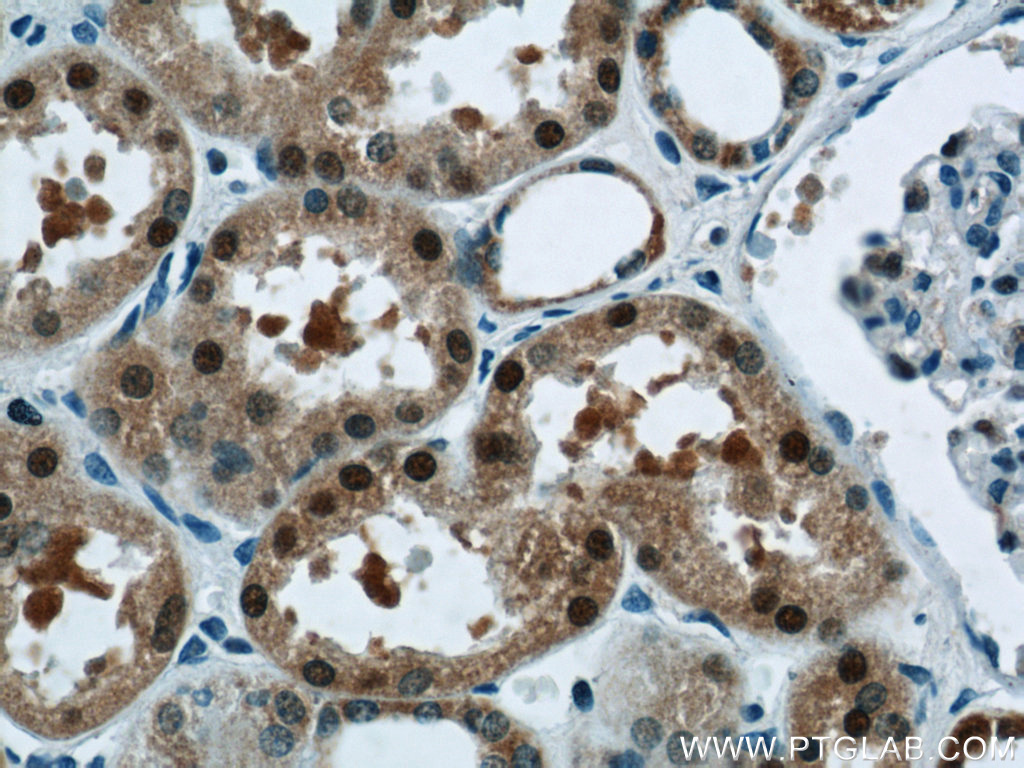 TRUB1 Polyclonal antibody