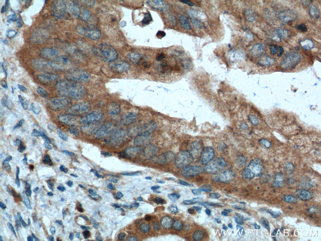 Amylase Alpha Polyclonal antibody