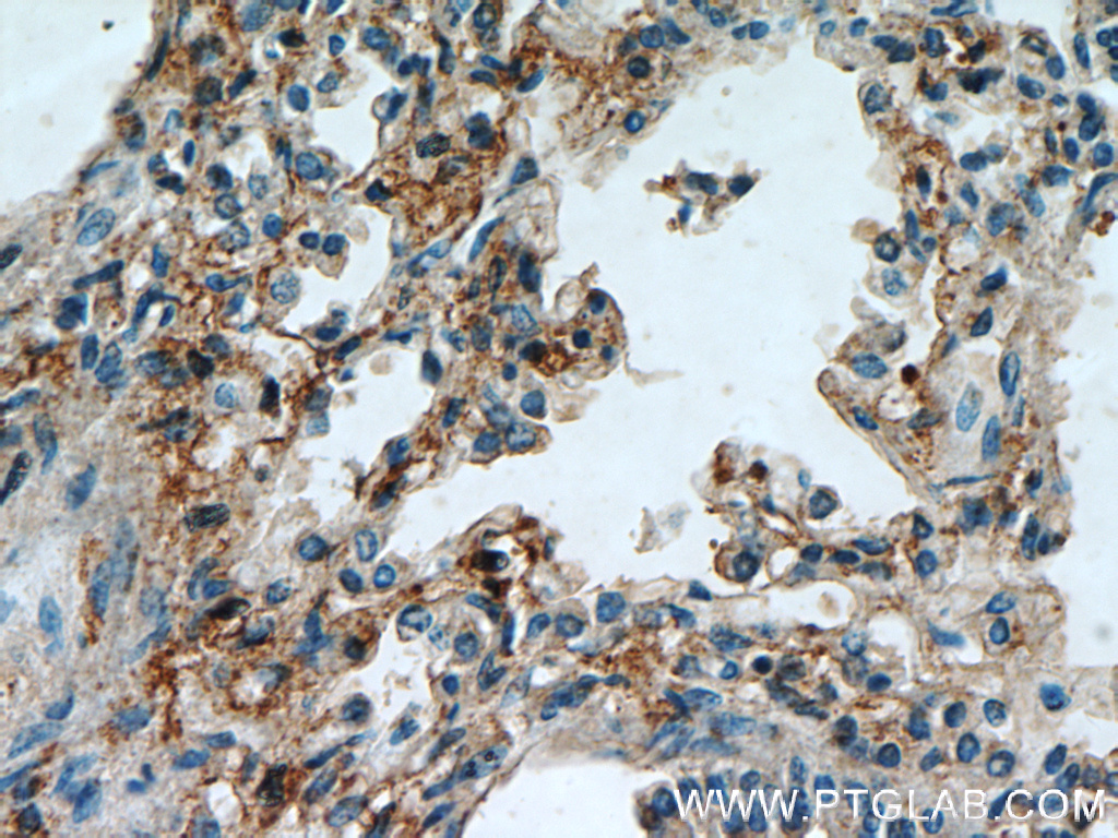 PIP5K1B Polyclonal antibody