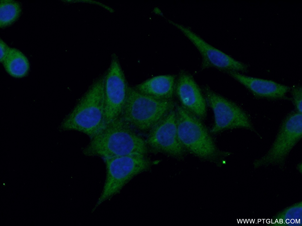 Annexin VI Polyclonal antibody