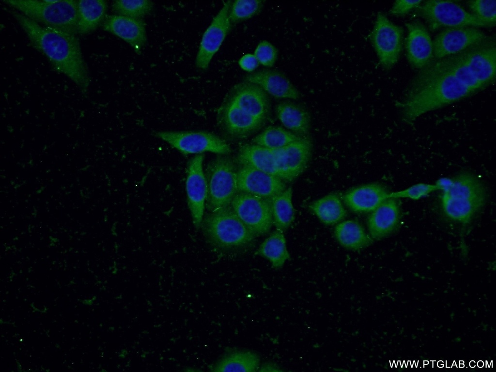 SQLE Polyclonal antibody