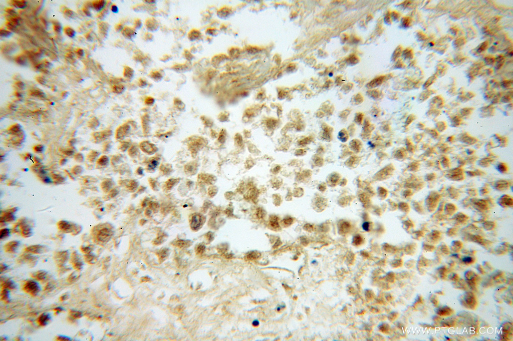 FUT8 Polyclonal antibody