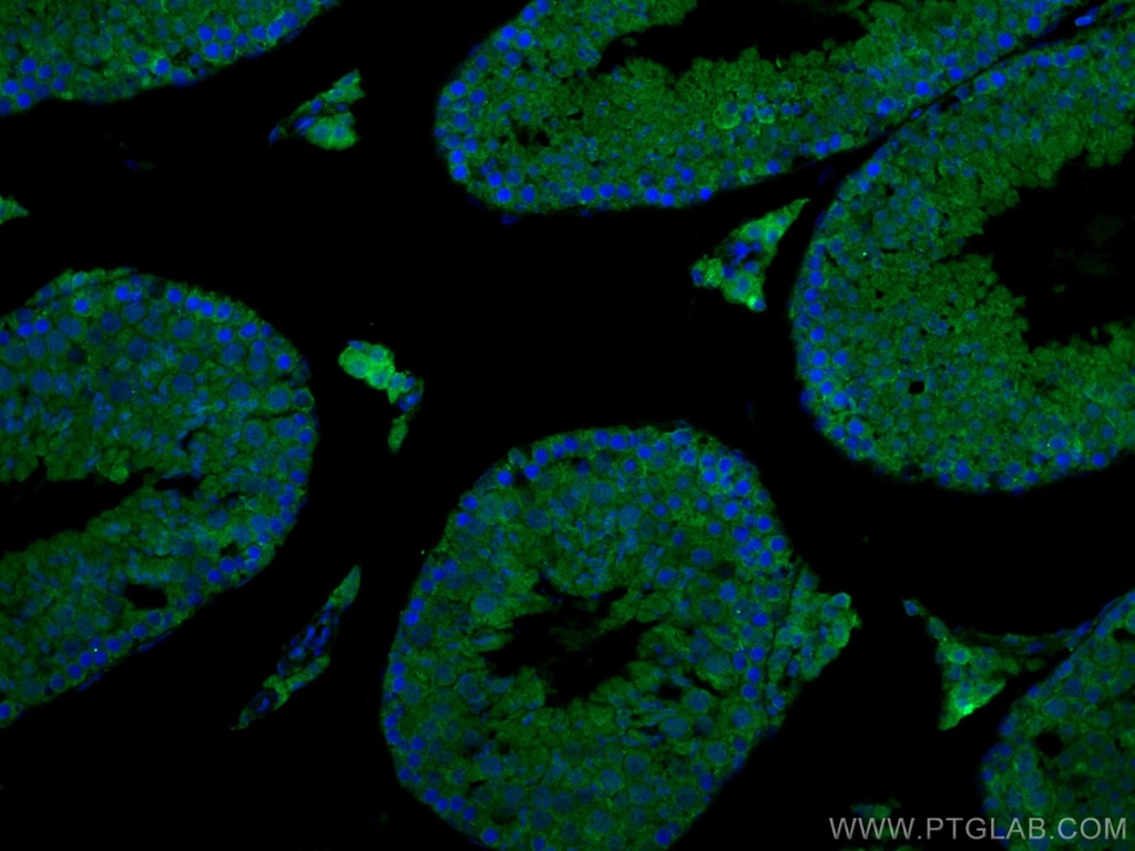 EPAC1 Polyclonal antibody