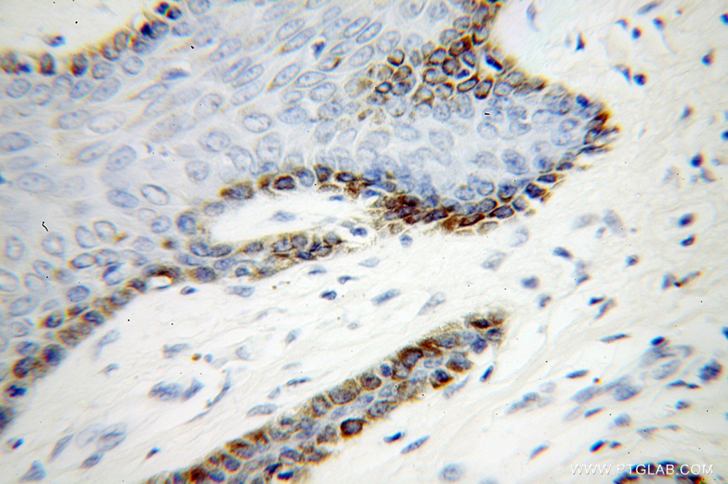 UBE2Q2 Polyclonal antibody