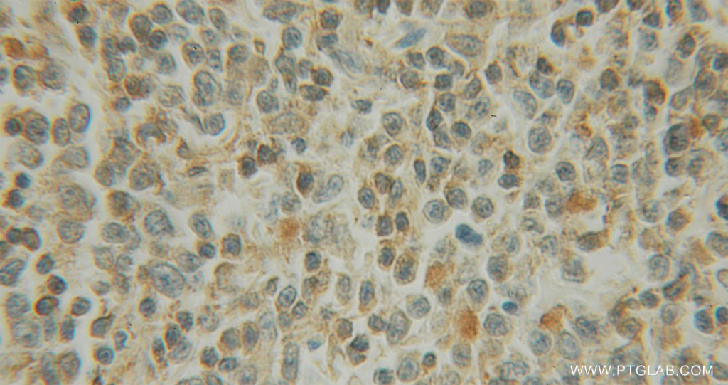 EXOSC1 Polyclonal antibody