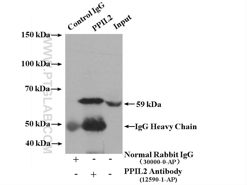 PPIL2 Polyclonal antibody