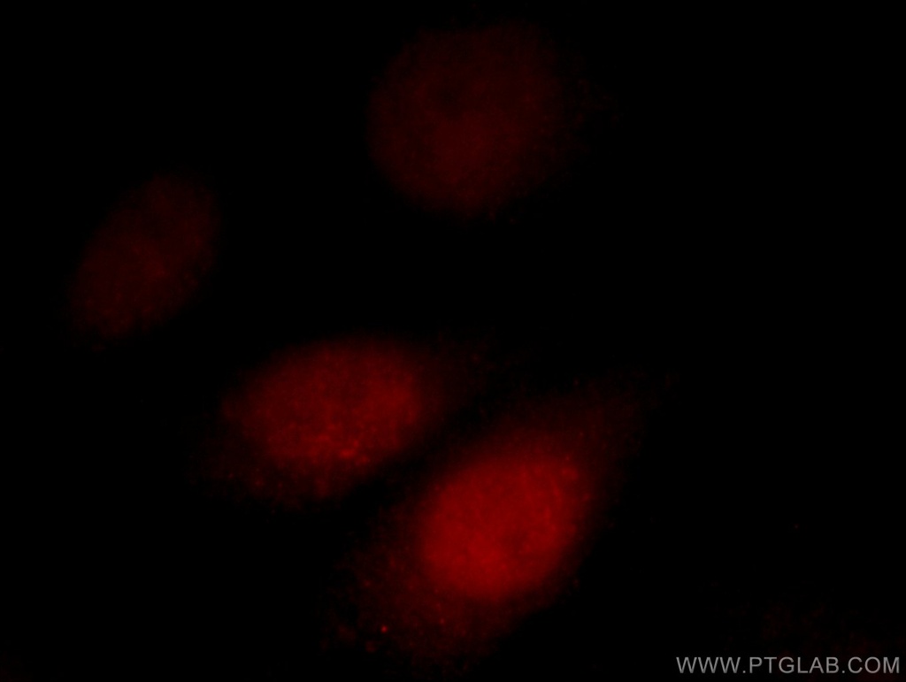 AKAP7 Polyclonal antibody