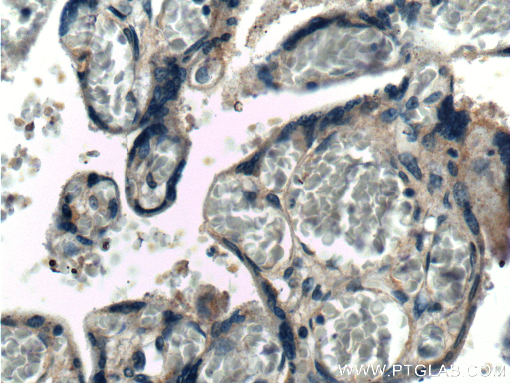 Integrin Beta 1 Polyclonal antibody