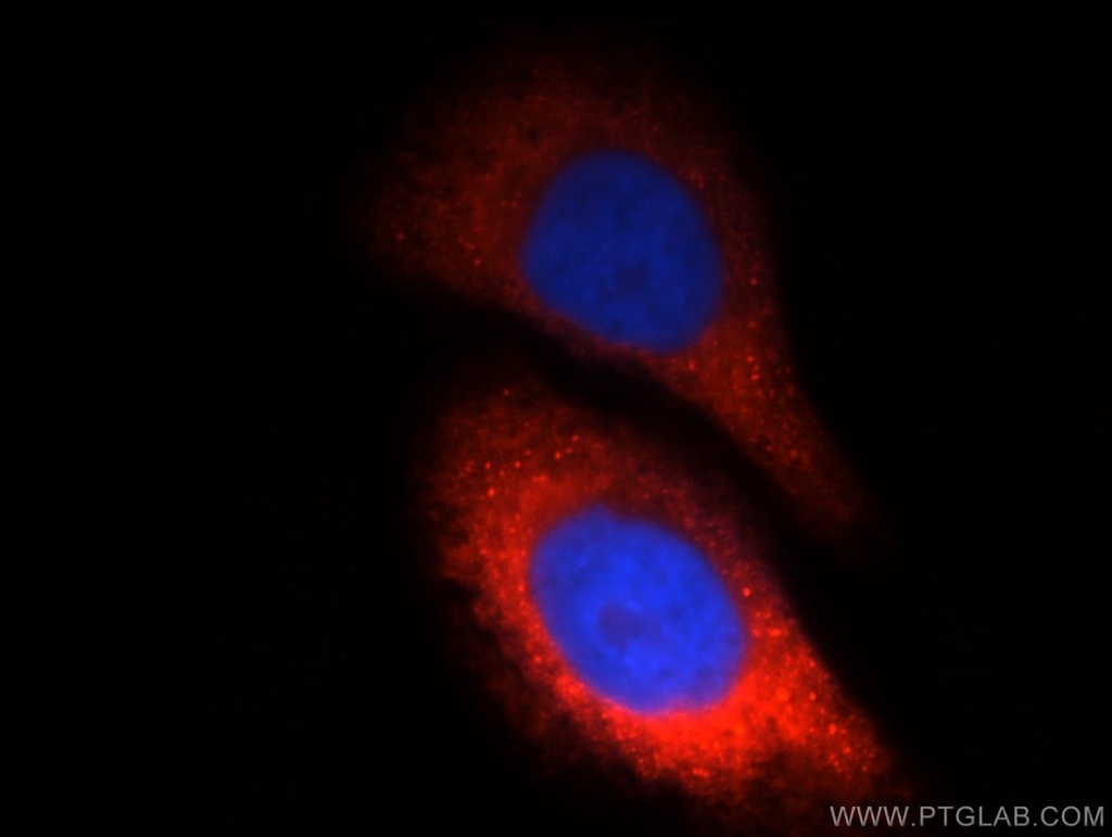 CTBS Polyclonal antibody