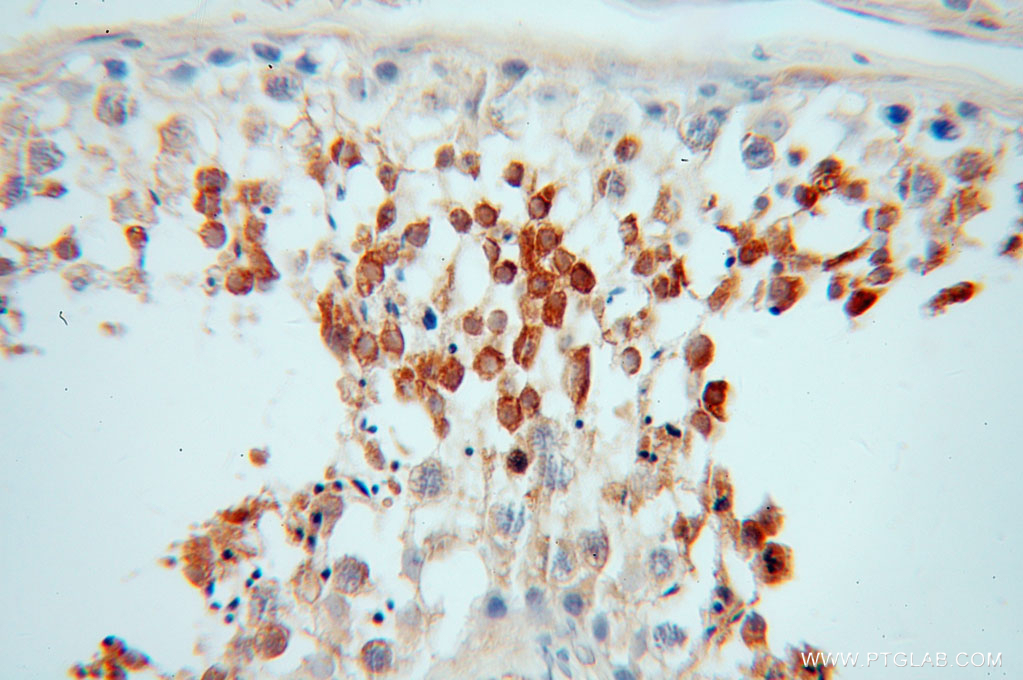 PABPC3 Polyclonal antibody