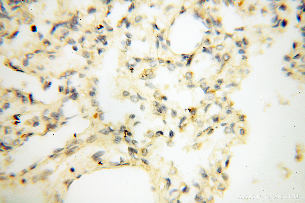 LAMP3 Polyclonal antibody