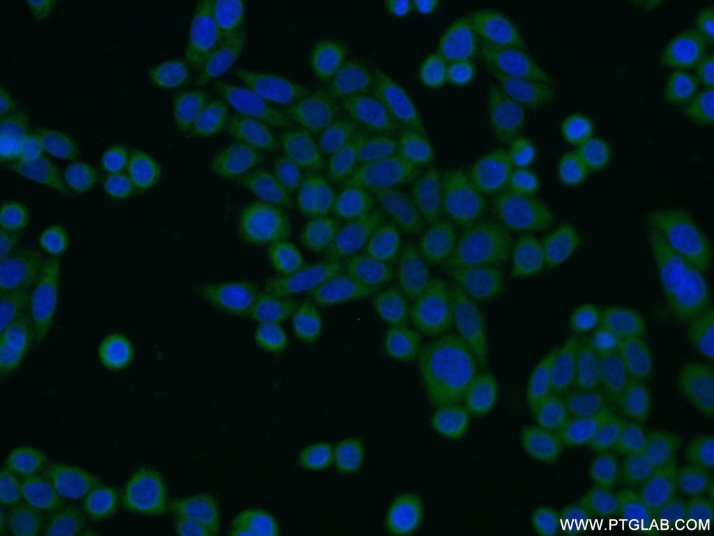CIAPIN1 Polyclonal antibody