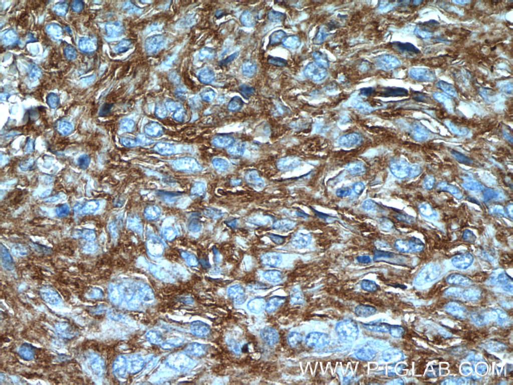 TMEM16A/DOG1 Polyclonal antibody