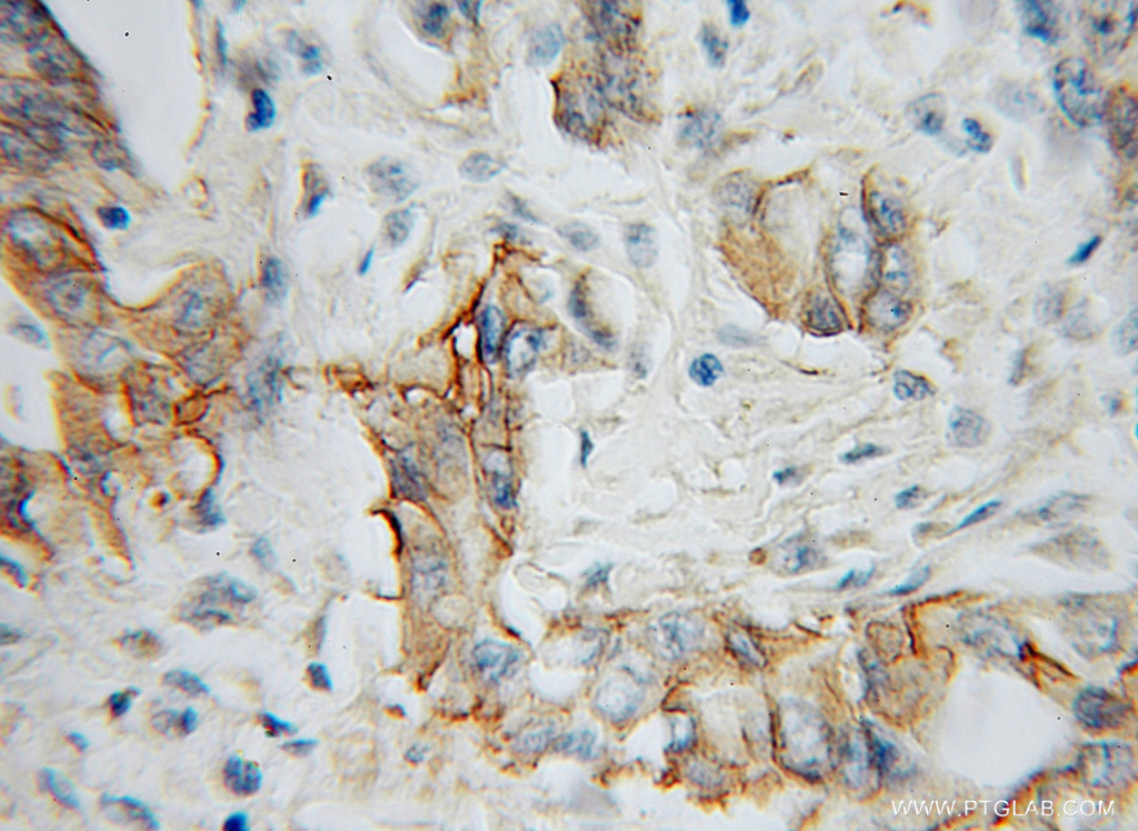 IL-5RA Polyclonal antibody