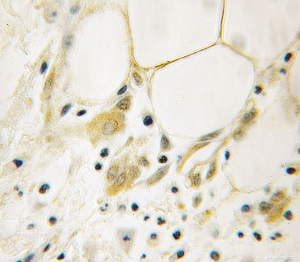 AGFG1 Polyclonal antibody