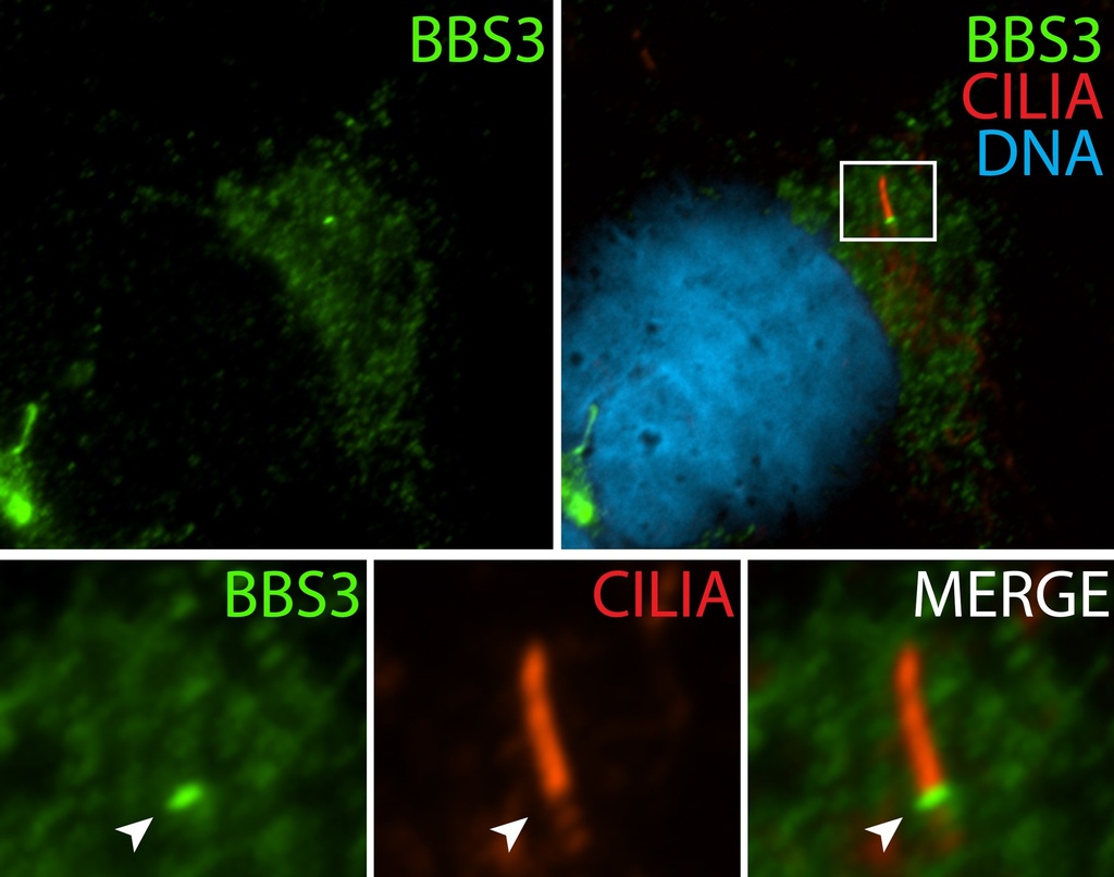BBS3 Polyclonal antibody