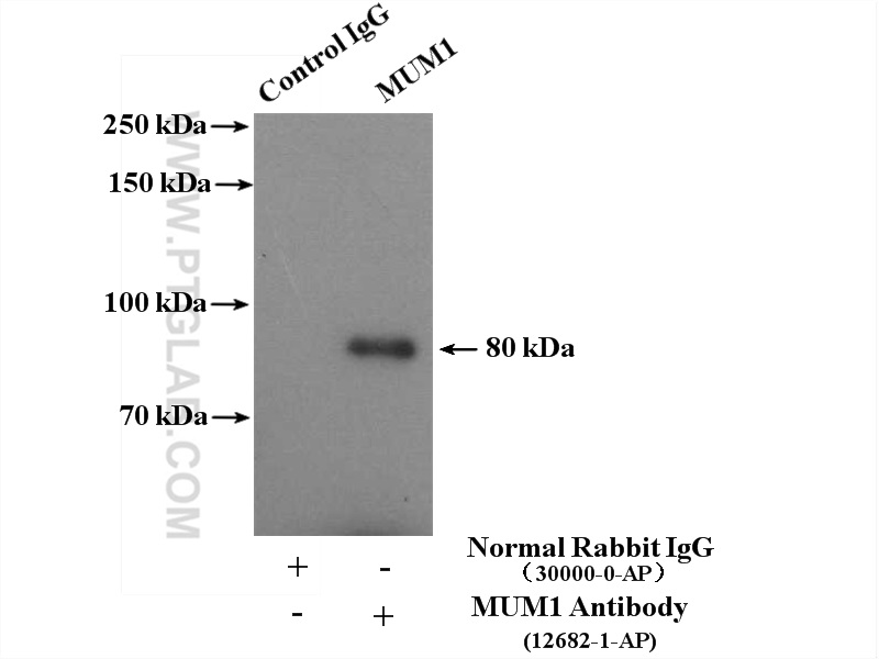 MUM1 Polyclonal antibody